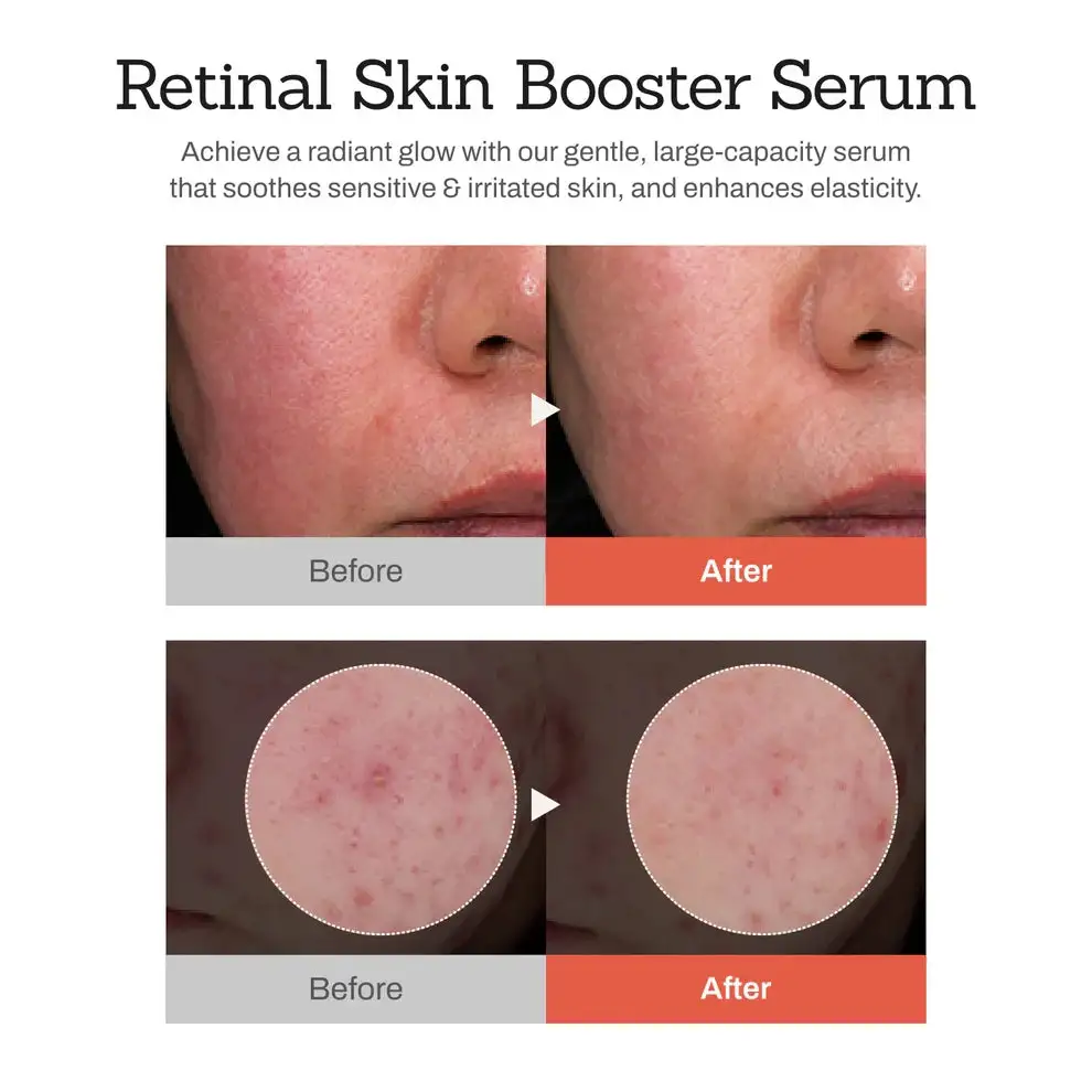 Retinal Skin Booster Serum - Image 5