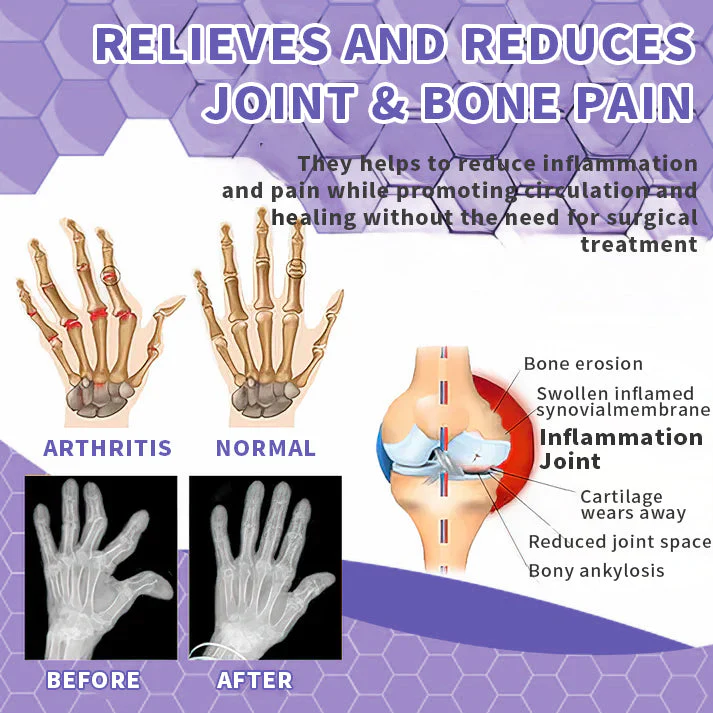 Snake Venom Joint Therapy Pain Relief Gel - Image 3