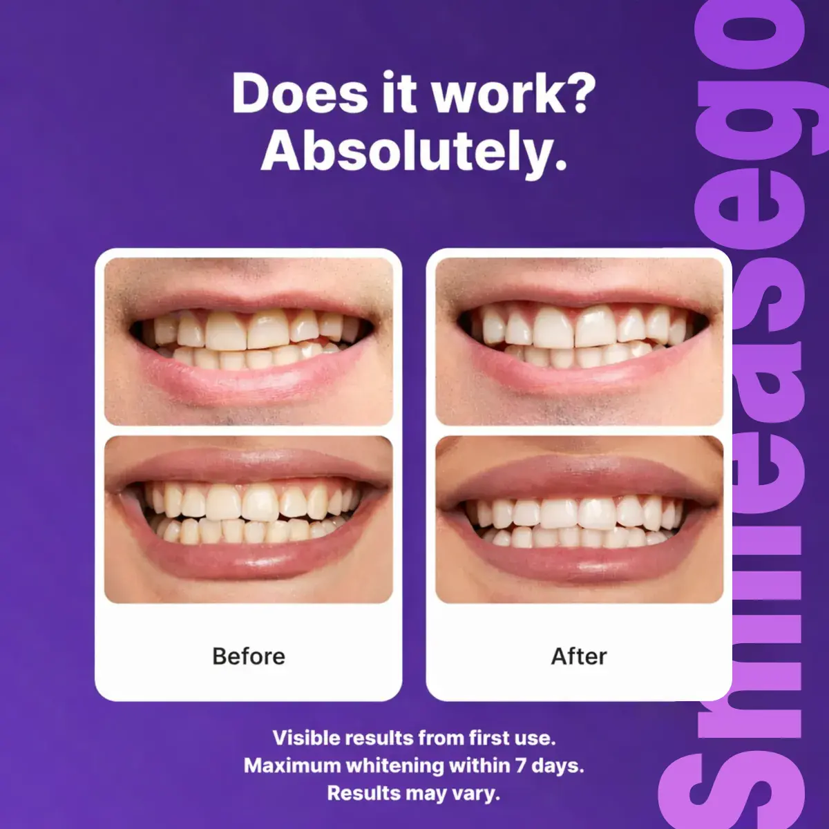 Purple Teeth Whitening Strips - Image 4