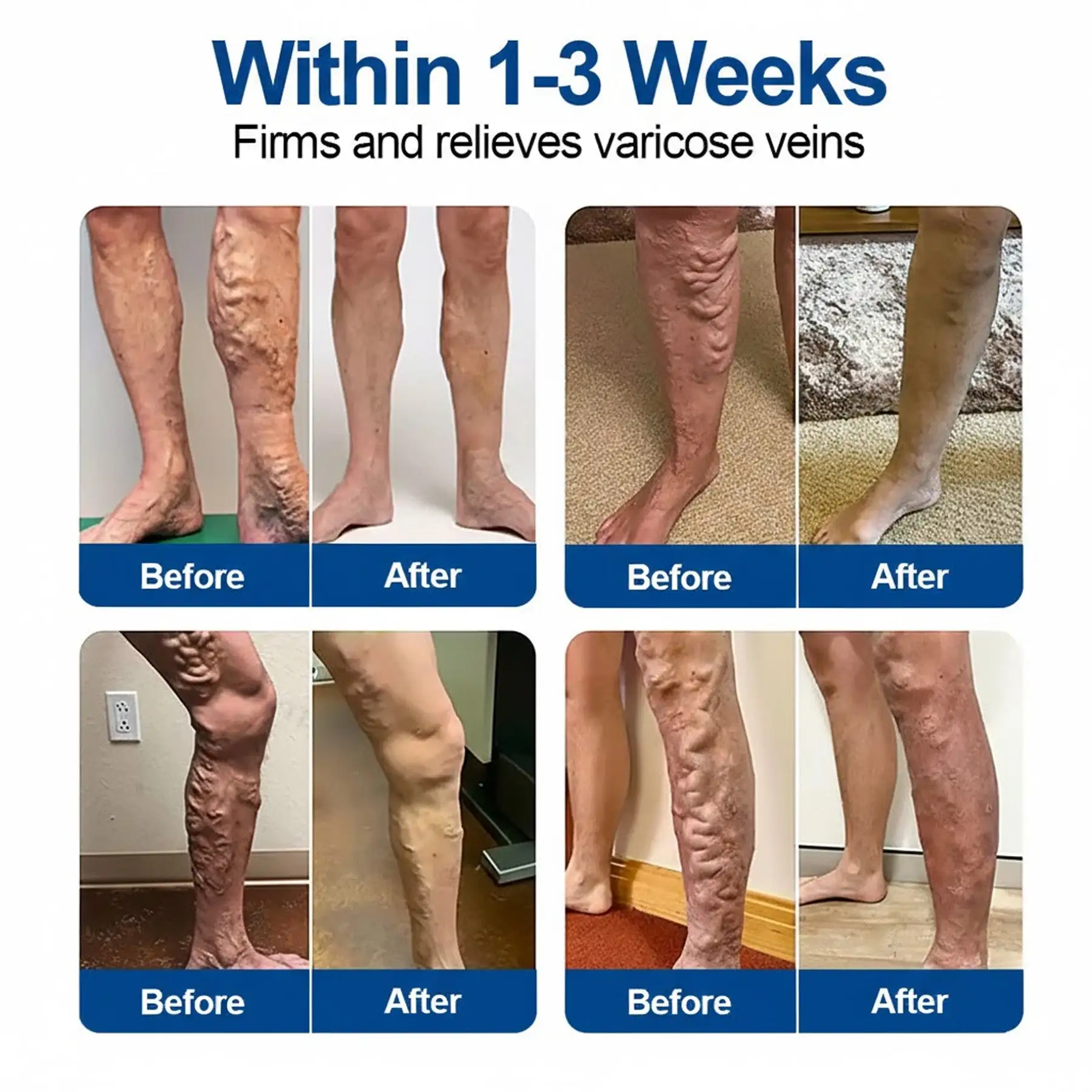 VeinEase Microneedle Care Patch⚡Instant Relief, Long-Term Results - Image 3