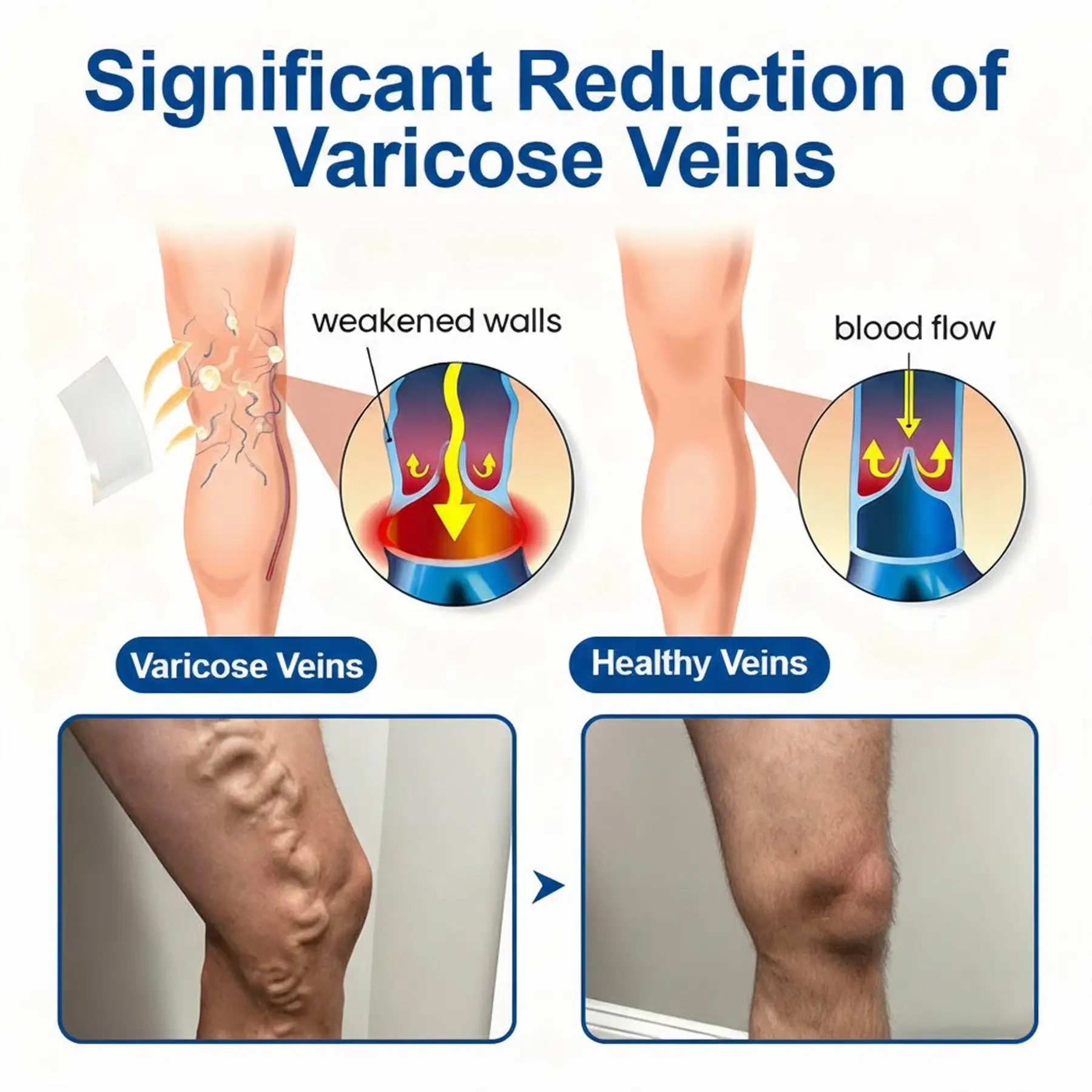 VeinEase Microneedle Care Patch⚡Instant Relief, Long-Term Results - Image 4