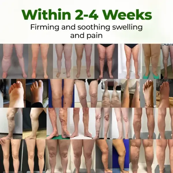 Professional Leg Circulation Cream - Image 2