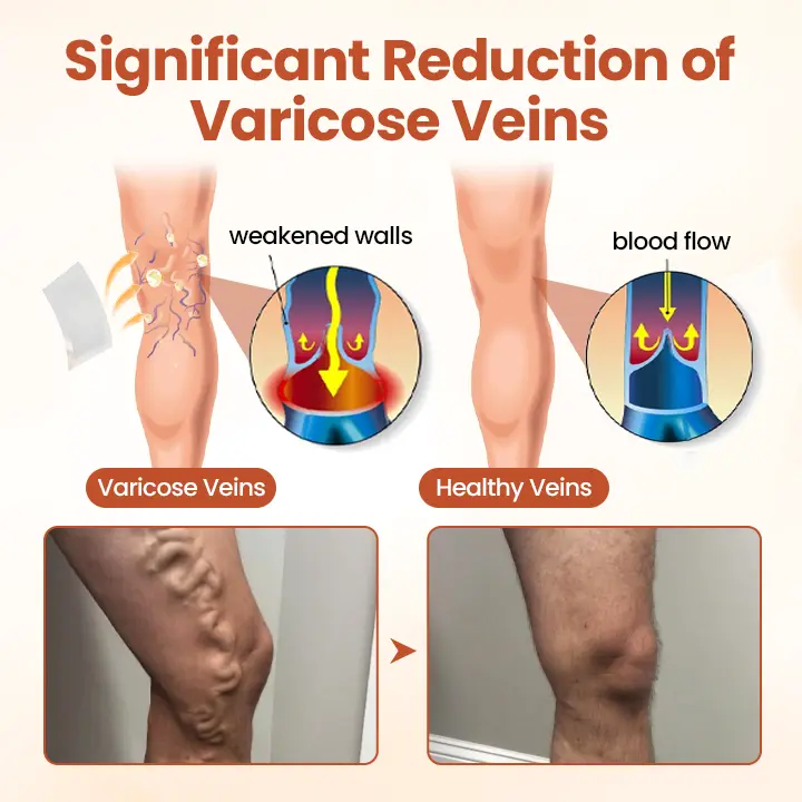 VeinTarget Microneedle Patch - Image 3
