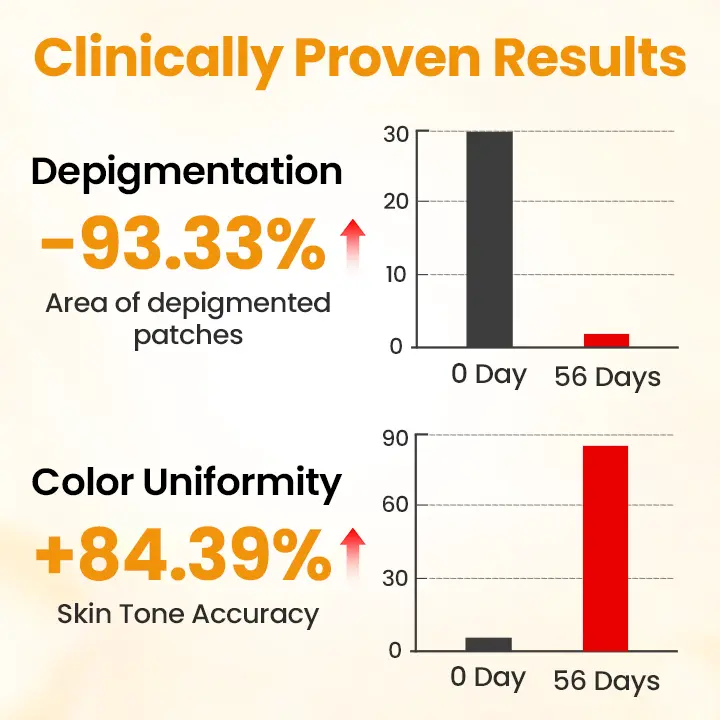 VitiGone Rapid Spray — 2–3 Week Repigmentation with OTDS - Image 3