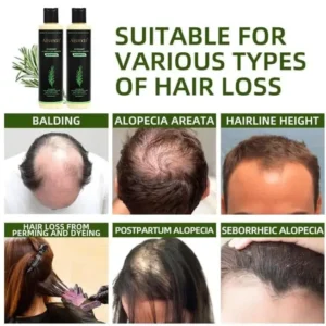 Alternative view of 🔥**¡ÚLTIMO DÍA: 50% DE DESCUENTO!** - 🎅Champú orgánico de romero para el crecimiento del cabello