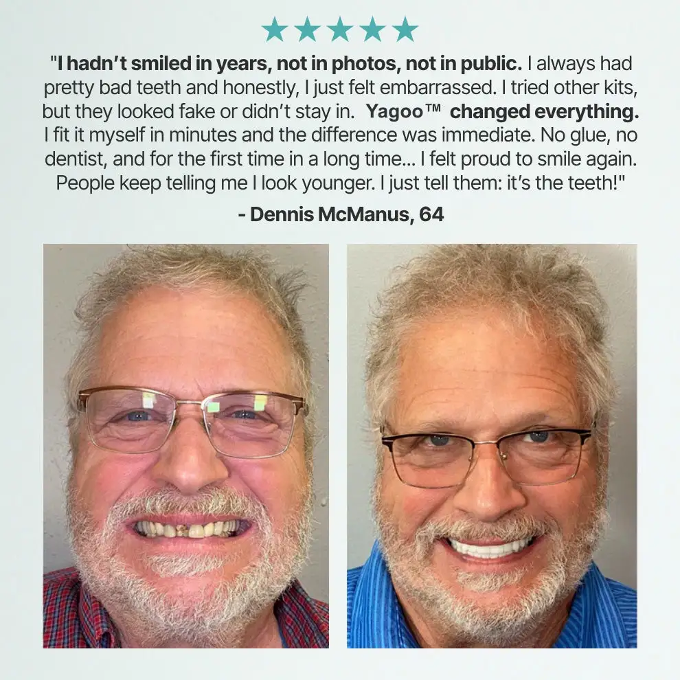 Custom Custom-Fit Full Functional DenturesMake you more confident - Image 4