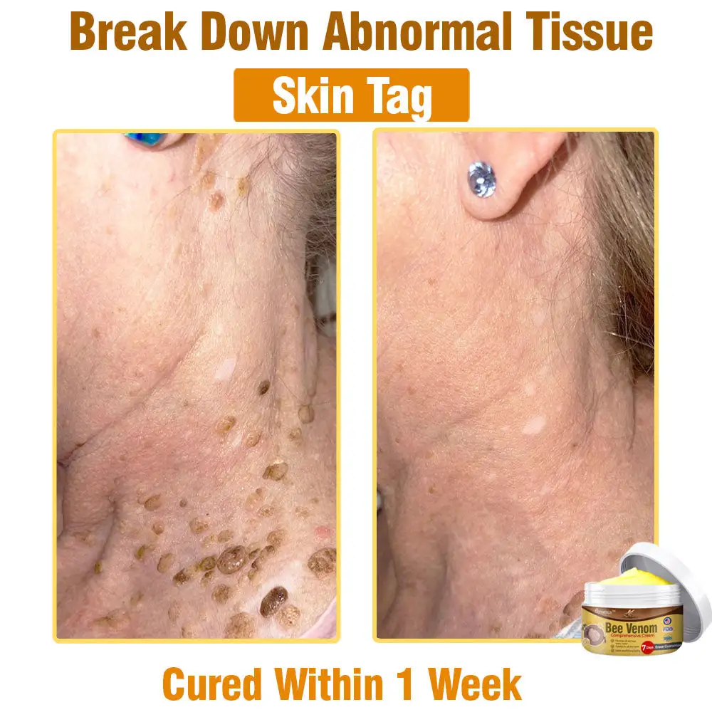Bee Venom Comprehensive Skin Treatment Cream - Image 5