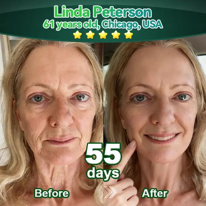𝖢𝗁𝗅𝗈𝗋𝗈𝗉𝗁𝗒𝗅𝗅 & 𝑆𝑡𝑒𝑚 𝐶𝑒𝑙𝑙 𝖻𝗈𝖽𝗒 R𝖾𝗇𝖾𝗐𝖺𝗅 S𝖾𝗋𝗎𝗆 - Image 3