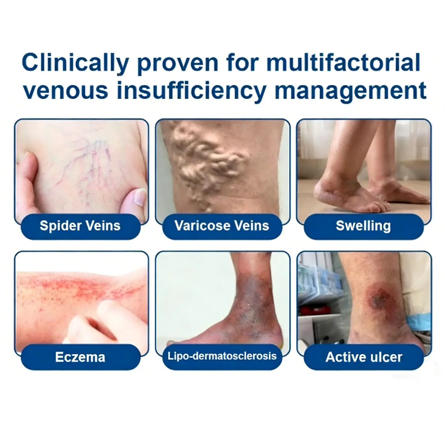 Vein Contour Micro-Patches: The 7-Day Transformation for Varicose Veins - Image 3