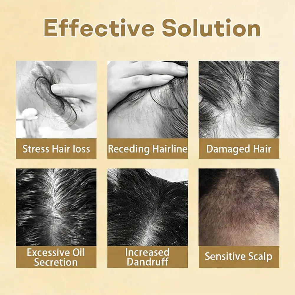 Hair Regrowth Capsules - Image 11