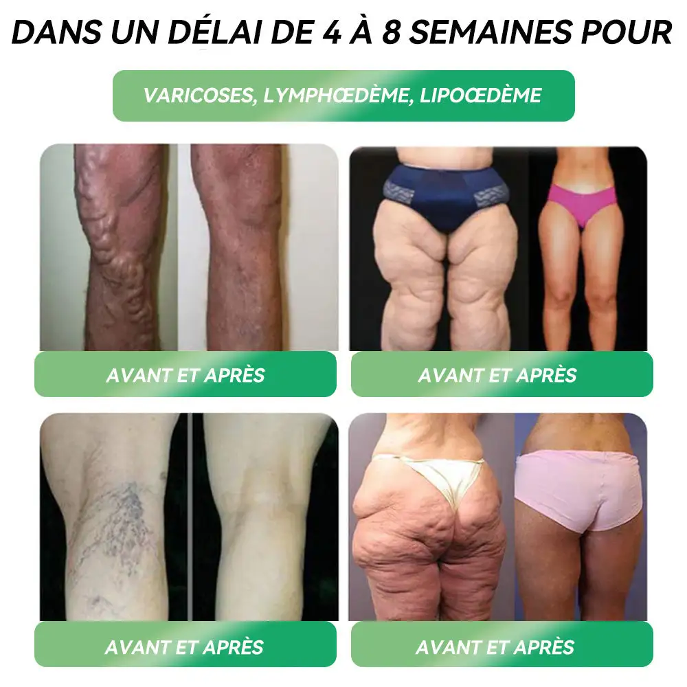 Solution Orale pour la 𝑝𝑒𝑟𝑑𝑒 𝑑𝑒 𝑝𝑜𝑖𝑑𝑠 - Image 5