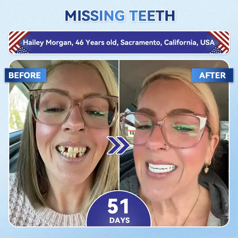 𝟓-𝒊𝒏-𝟏 𝑻𝒊𝒅𝒆𝒈𝒍𝒖𝒔𝒊𝒃 𝑻𝒐𝒐𝒕𝒉 𝑶𝒓𝒂𝒍 𝑺𝒕𝒓𝒊𝒑𝒔 & Gum Repair Oral Strips - Image 5