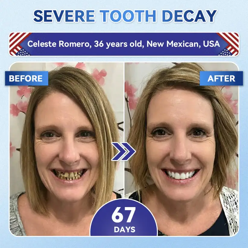 𝟓-𝒊𝒏-𝟏 𝑻𝒊𝒅𝒆𝒈𝒍𝒖𝒔𝒊𝒃 𝑻𝒐𝒐𝒕𝒉 𝑶𝒓𝒂𝒍 𝑺𝒕𝒓𝒊𝒑𝒔 & Gum Repair Oral Strips - Image 7
