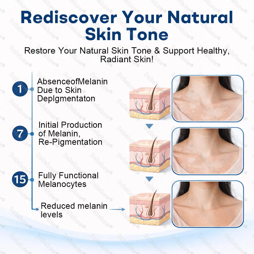 Piperine Vitiligo Repigmentation Spray - Image 5