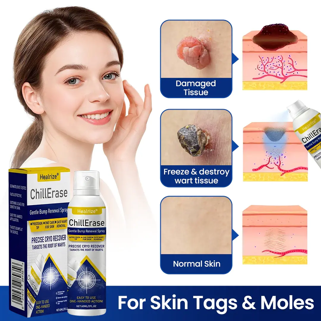 ChillErase Gentle Bump Renewal Spray - Image 2
