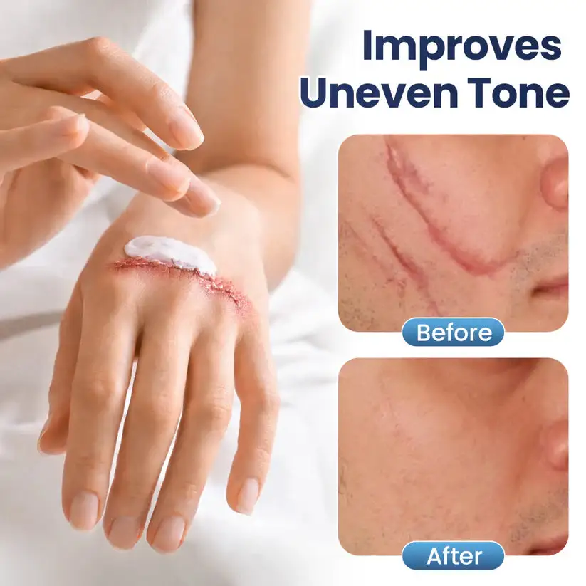 Texture Repair Gel - Image 9