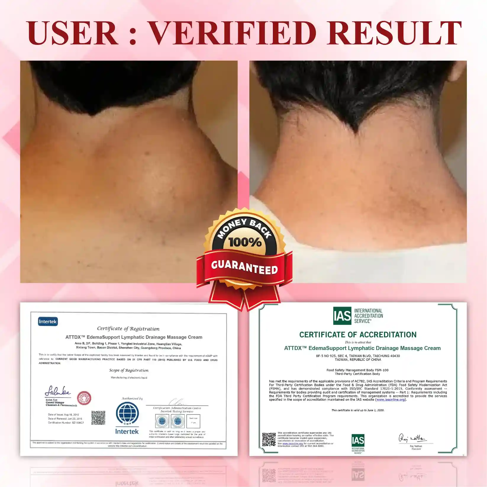 EdemaSupport Lymphatic Drainage Massage Cream - Image 6