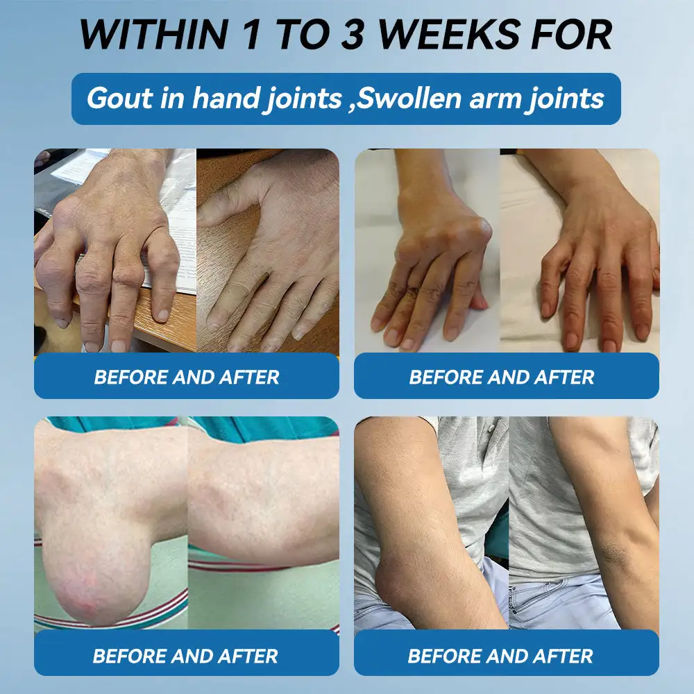 BPC-157 Joint Healing Cream - Image 6