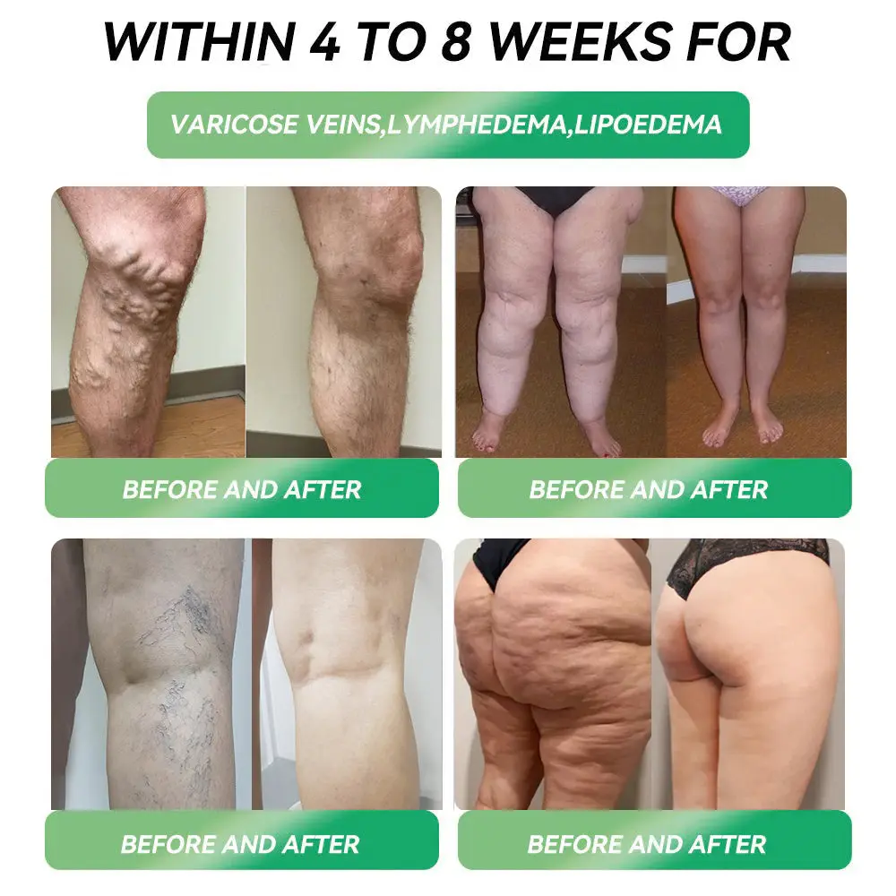 Oral Solution - Dual-Action Weight Loss Solution - Image 4