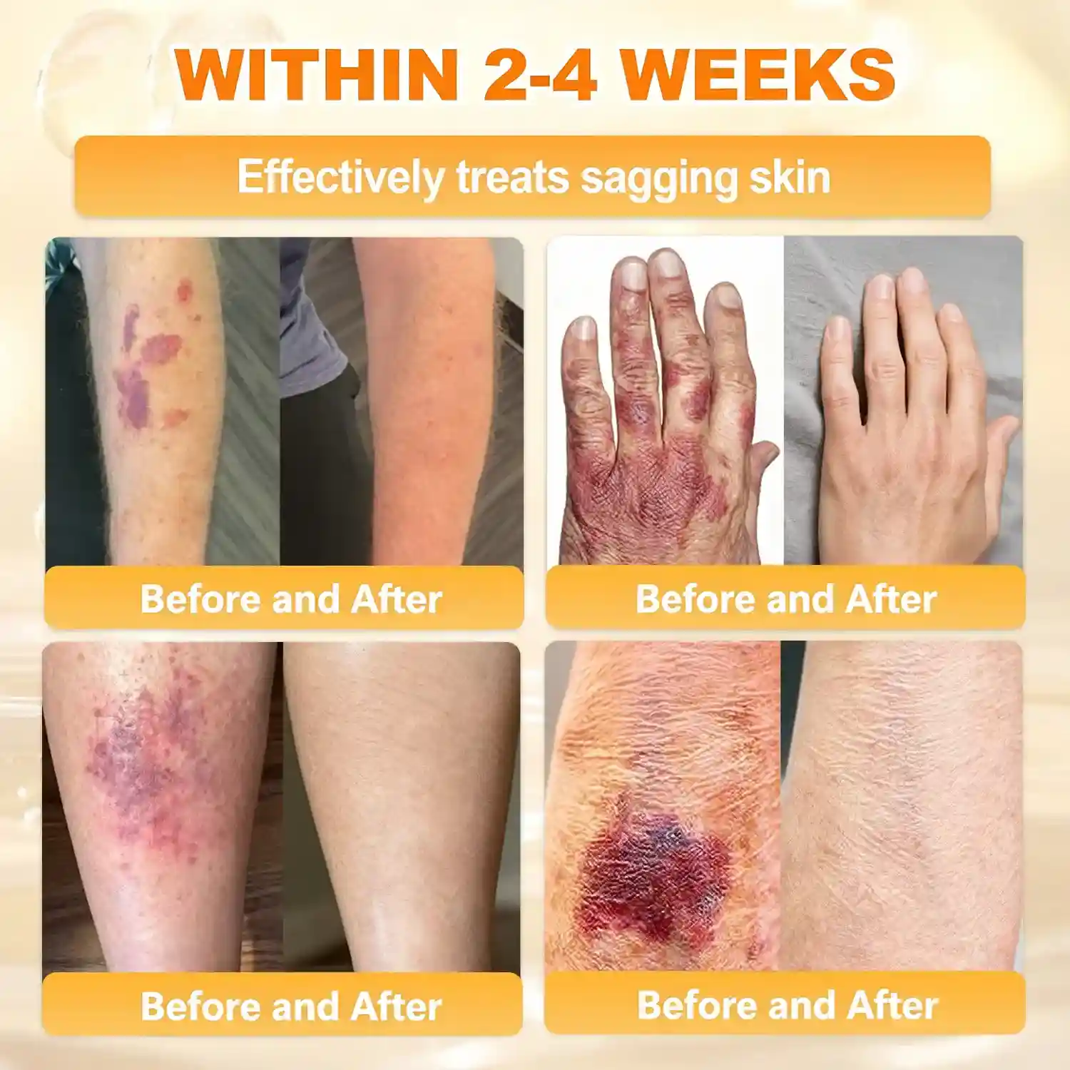 Bee Poison Skin Renewal Cream - Image 5