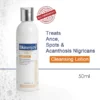 Cleansing Lotion for Acne & Spots & Acanthosis Nigricans Congratulations