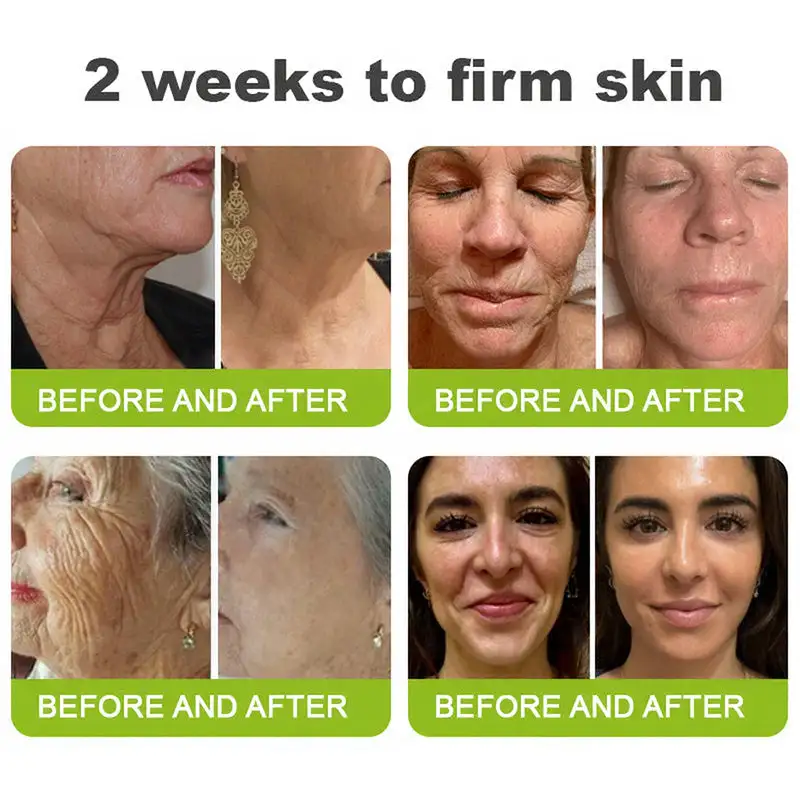 Retinol Shot: Firm & Lift - Image 7