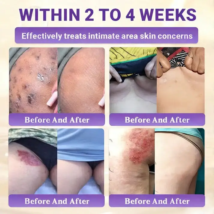 10-in-1 Skin Clear - Image 8