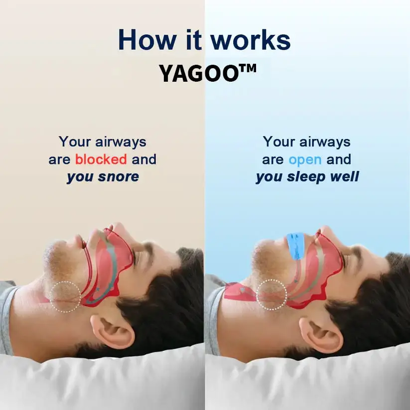Professional intelligent anti-snoring device - Image 2
