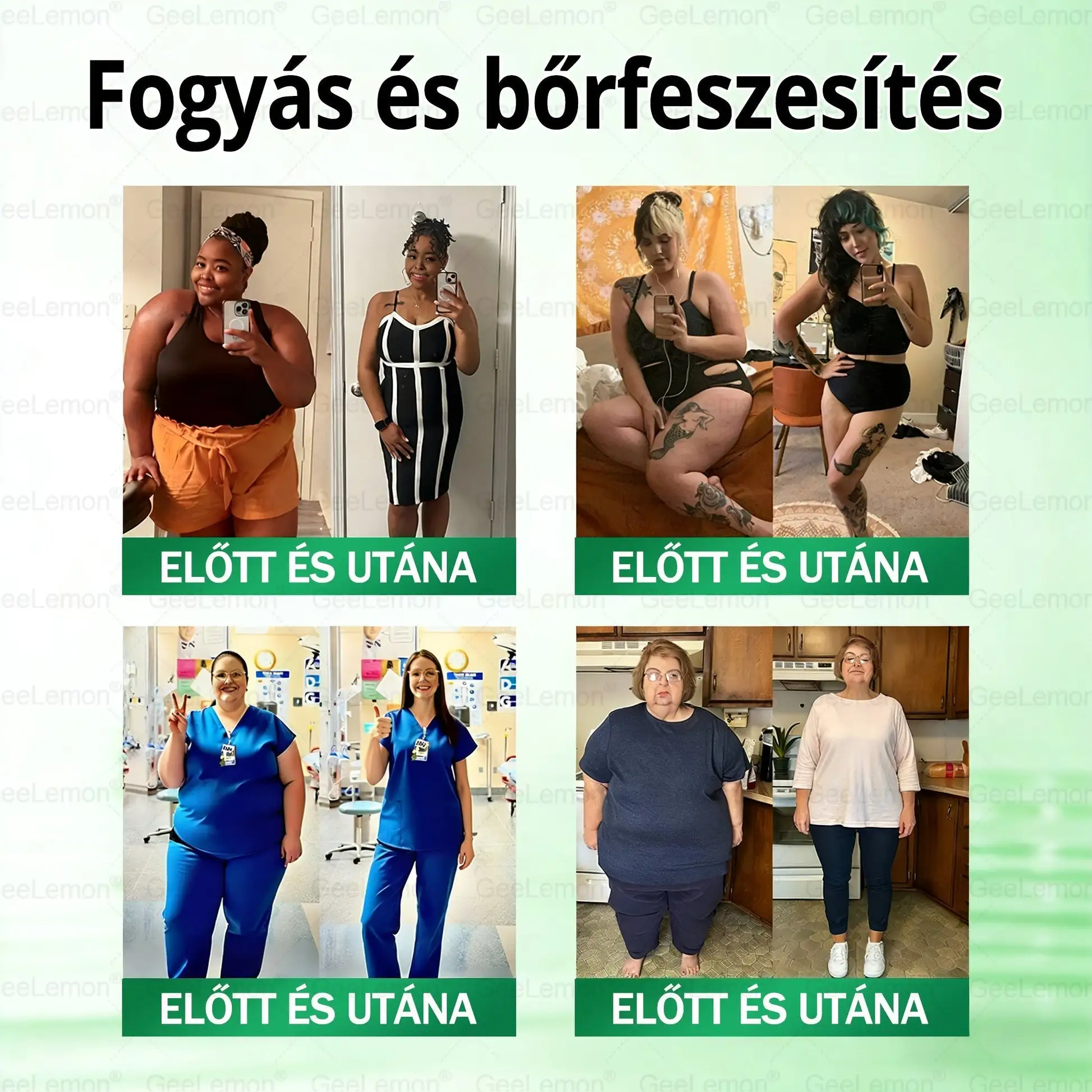 Glumasetide 8az 1-ben Karcsú és EgészségesNano Mikrotűs Tapasz - Image 3