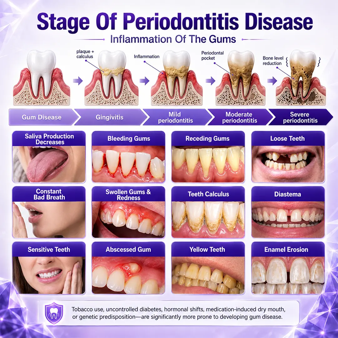 Gingivitis Periodontal Treatment Toothpaste - Image 3
