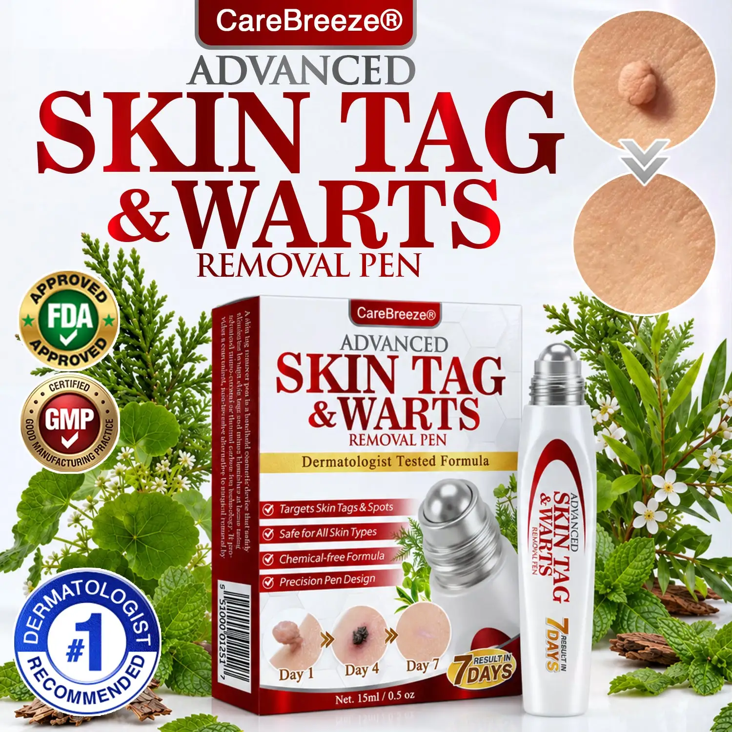 Herbal Skin Tag & Wart Removal Roller