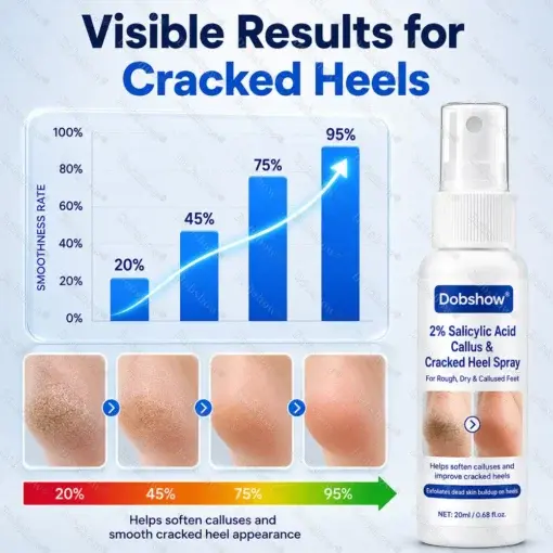 Medical-Grade 2% Salicylic Acid Callus & Cracked Heel Repair Spray - Image 11