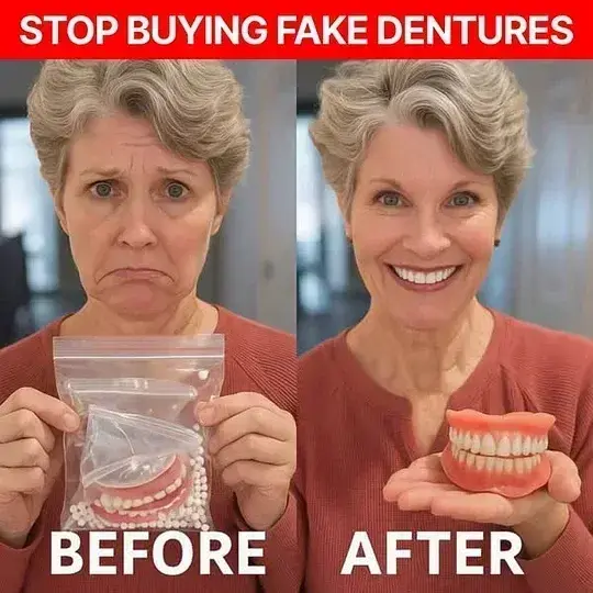 Custom Functional Dentures - Image 3