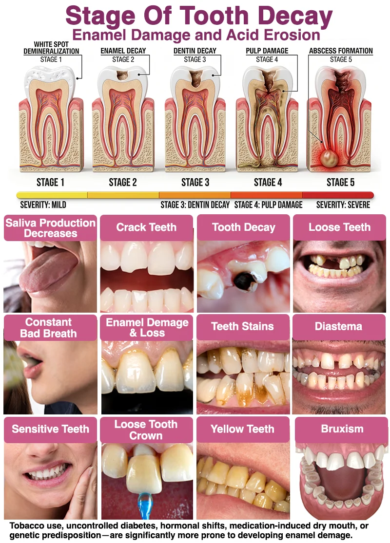 DenPerm Cavity-Repair Natural Enamel Filling Gel - Image 2