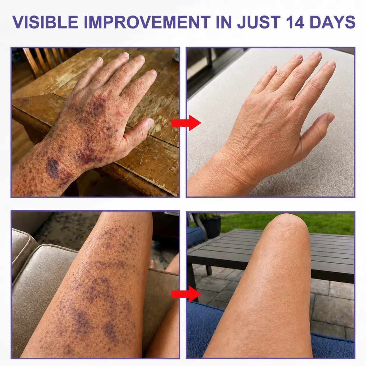 Newly Upgraded Dark Spot & Bruise Recovery Cream - Image 4
