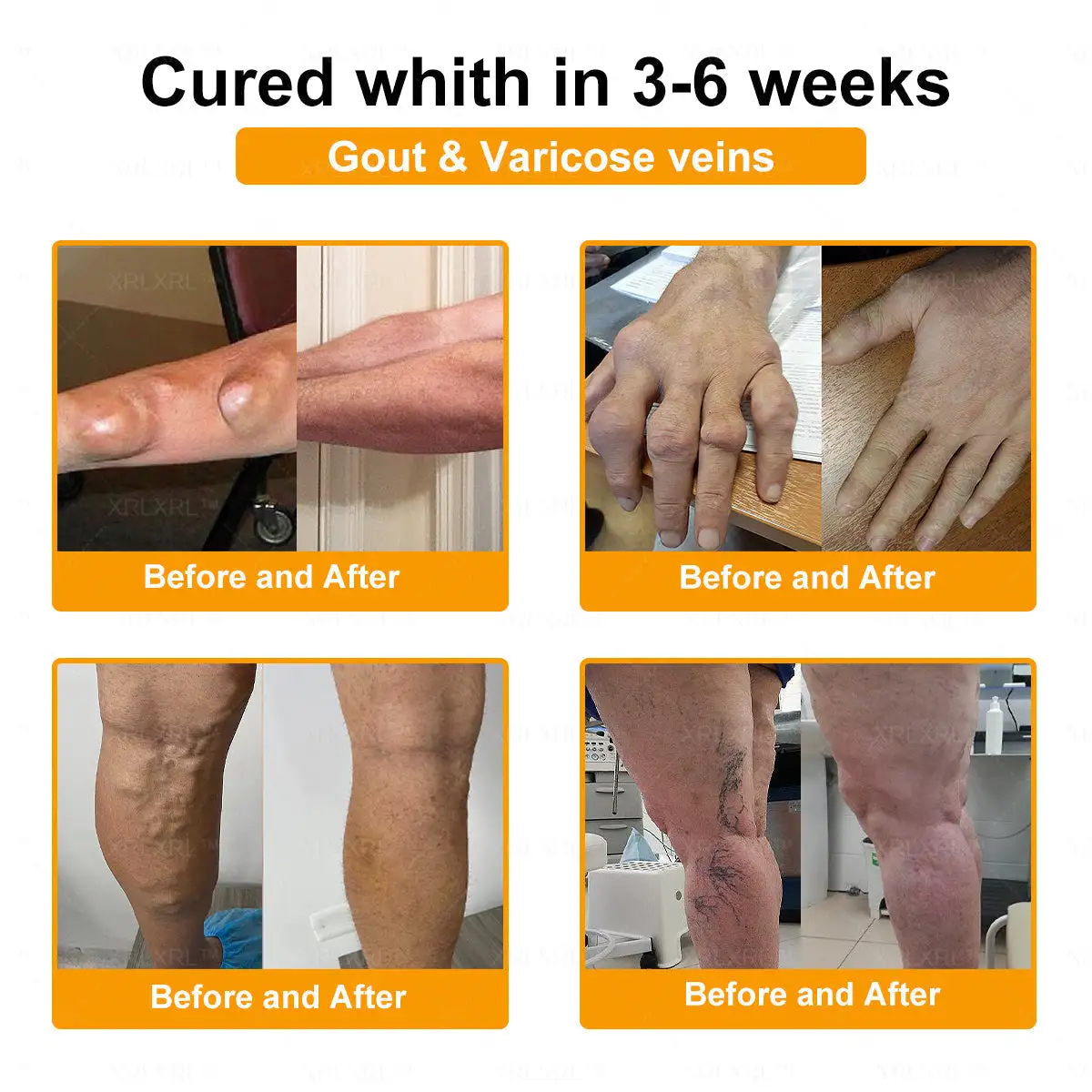 💞💞 Bee Venom Pain-Relief Bone Healing Cream - Image 6