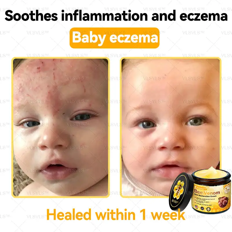 Bee Venom Skin Restoration Cream - Image 4