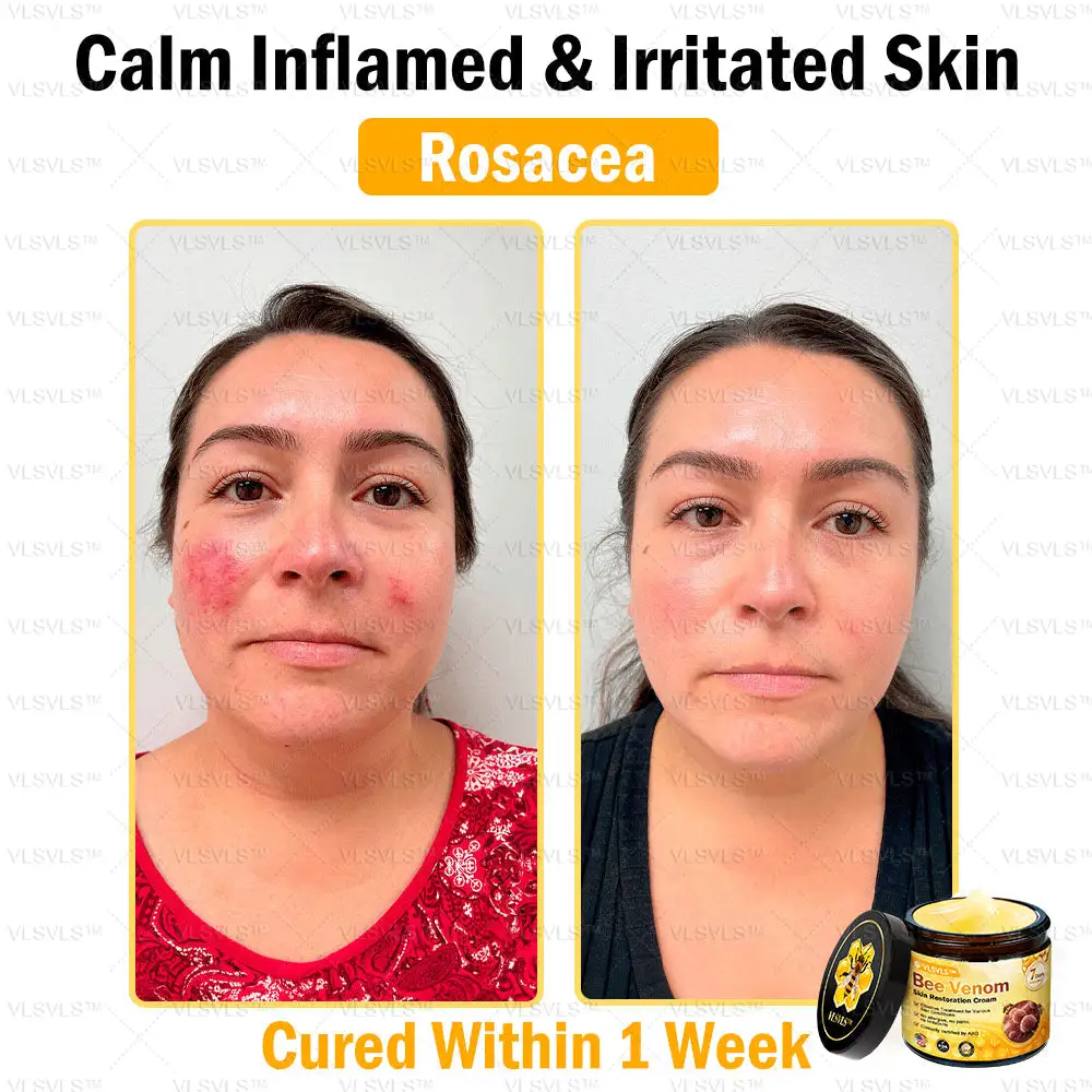 Bee Venom Skin Restoration Cream - Image 5