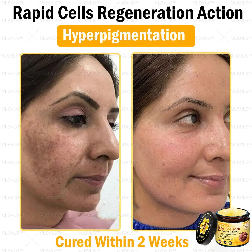 Bee Venom Skin Restoration Cream - Image 8